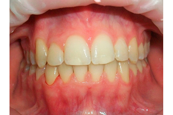 Ортодонтическое лечение